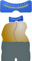 SKOLYOMETRE
